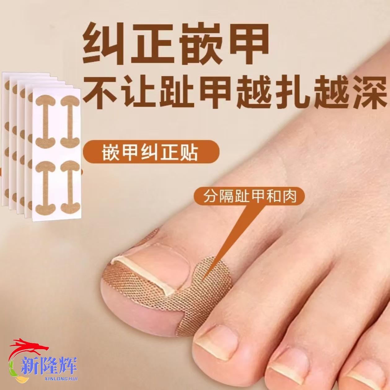 Cross-Border Popular Nail Repair and Correction Patches, Ingrown Nail Patches, Adhesive-Free Ingrown Nail Correction Patches