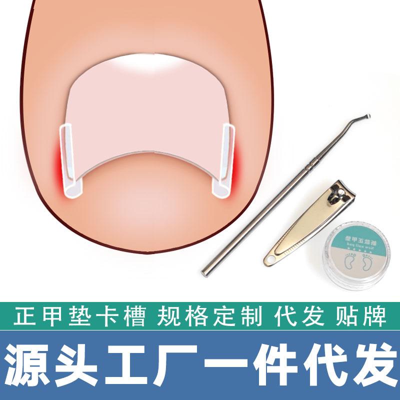 Nail Pad Nail Groove Inlay Nail Corrector Nail Pad Roll Nail Corrector Pull and Stick Toenail Long into Meat